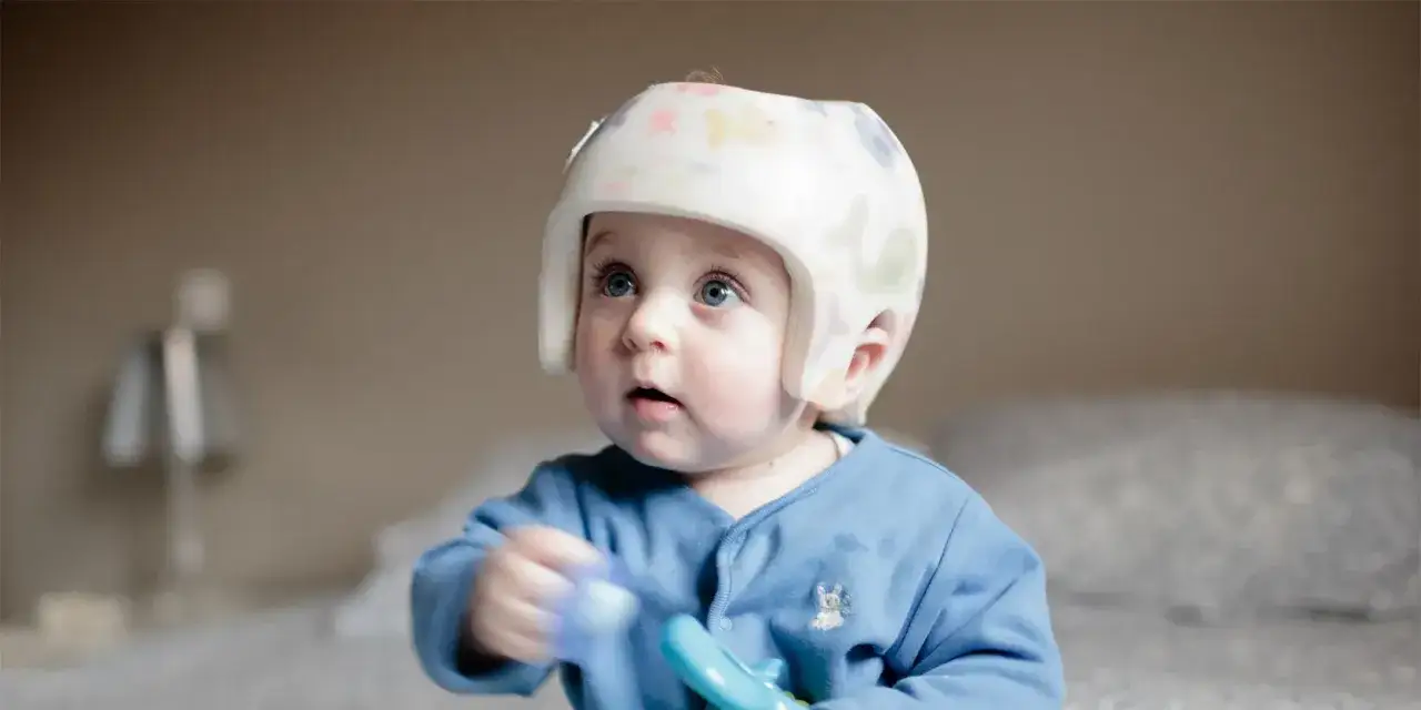 Niebieskooki maluch w kolorowym kasku korekcyjnym z zabawką w ręku.