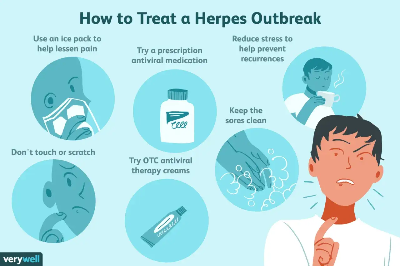 Ilustracja pokazuje, jak leczyć **herpes**: stosuj zimne okłady, leki przeciwwirusowe, unikaj drapania, dbaj o czystość ran i redukuj stres.