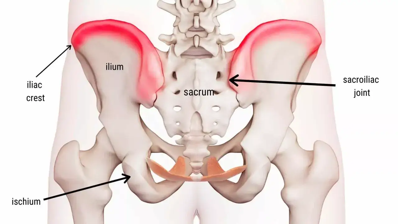 Anatomia miednicy z zaznaczonym rozejściem spojenia łonowego. Widoczne kości biodrowe (ilium, ischium), krzyżowa (sacrum) i stawy krzyżowo-biodrowe.