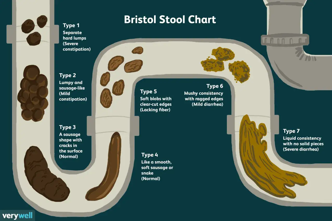 Wykres Bristol Stool Chart pokazuje 7 typów stolca, od twardych grudek (typ 1) po płynną konsystencję (typ 7).