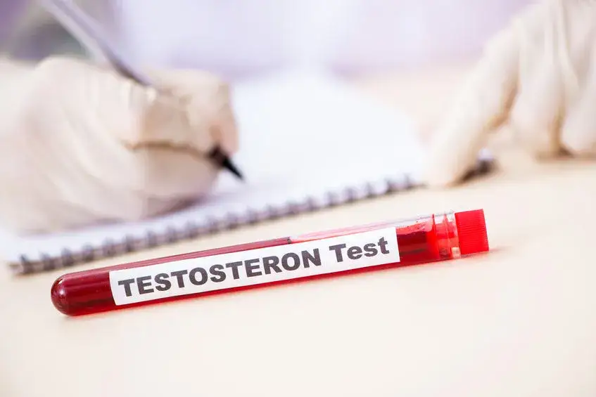 Cennik badania testosteronu laboratorium