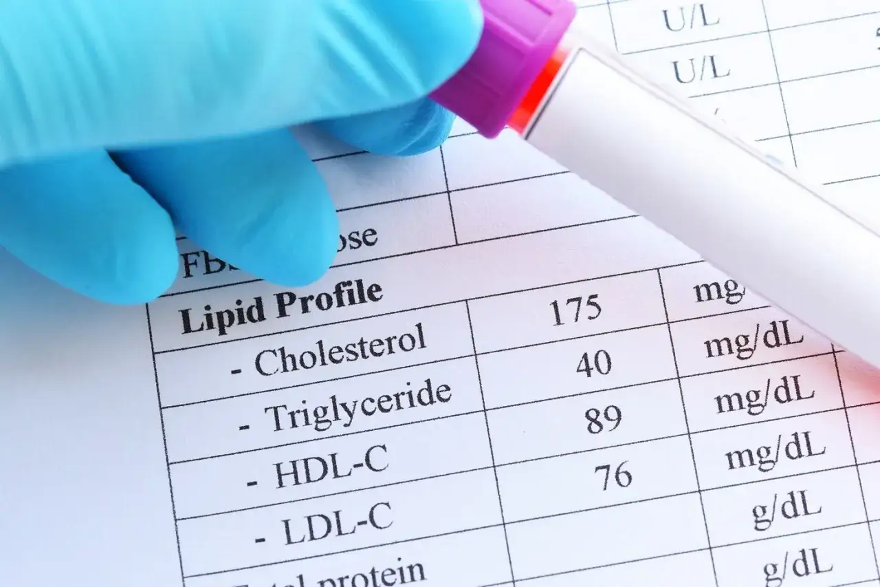 Przygotowanie do badania krwi na cholesterol