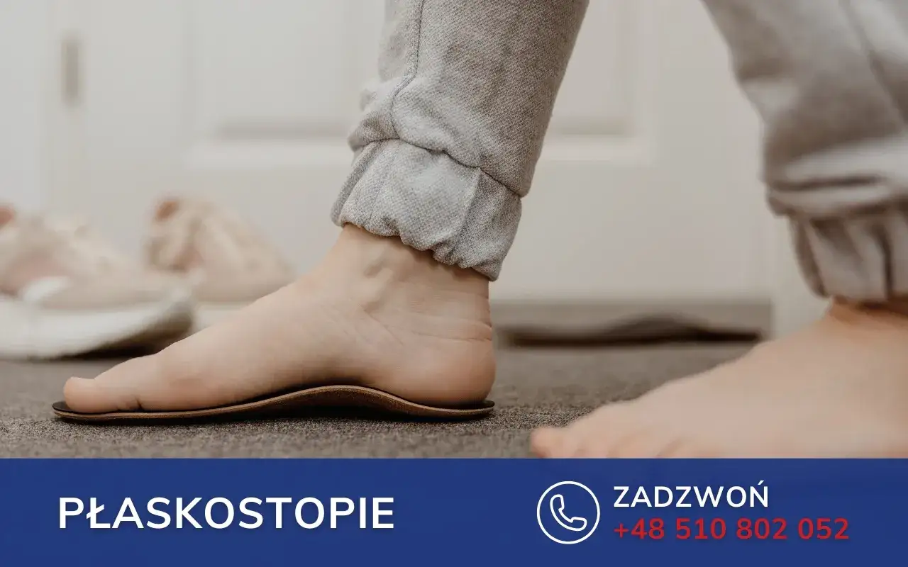 Stopa z wkładką ortopedyczną, która koryguje płaskostopie. W tle widać buty.