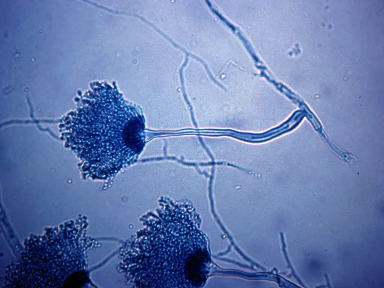 Strutture fungine bluastre al microscopio, conifere e ife. L'aspergillosi è contagiosa, un rischio da non sottovalutare.