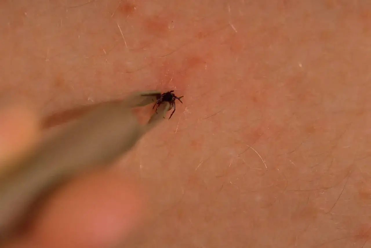 jak usunąć kleszcza nimfę instrukcja krok po kroku