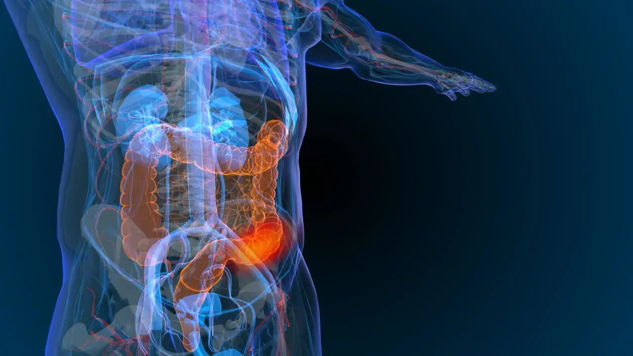 Chemioterapia adjuwantowa rak jelita grubego