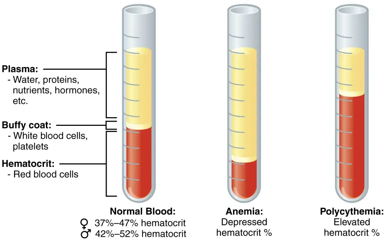 Porównanie morfologii krwi: prawidłowa, anemia (niski hematokryt) i policytemia (wysoki hematokryt).