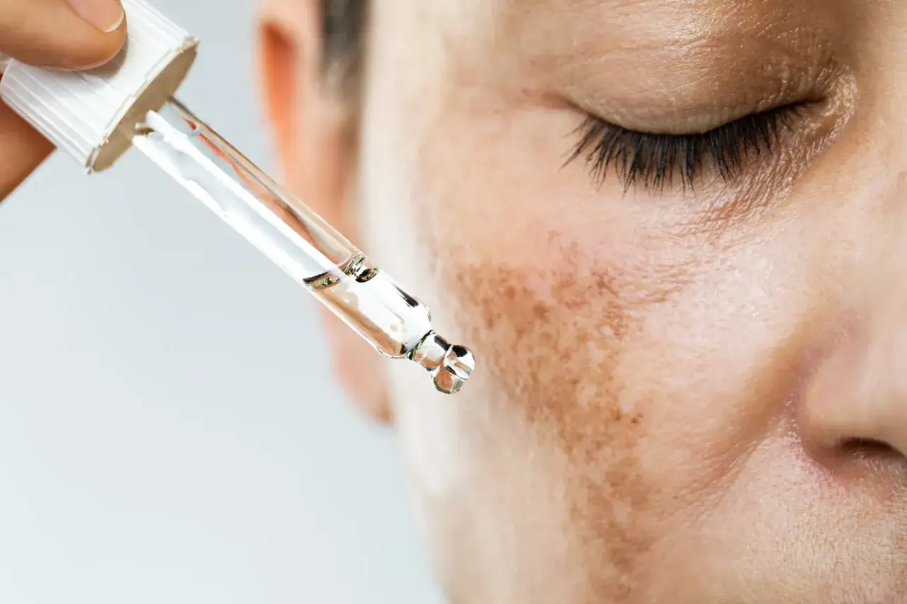 Goutte d'un s&eacute;rum sur la peau, pour un traitement hyperpigmentation.