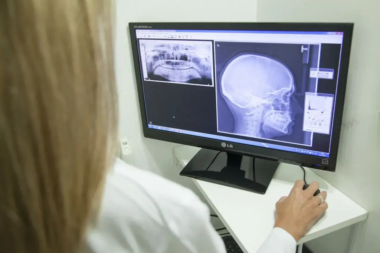 Lekarz analizuje RTG zębów i czaszki na monitorze. To pokazuje, jak działa diagnostyka obrazowa.