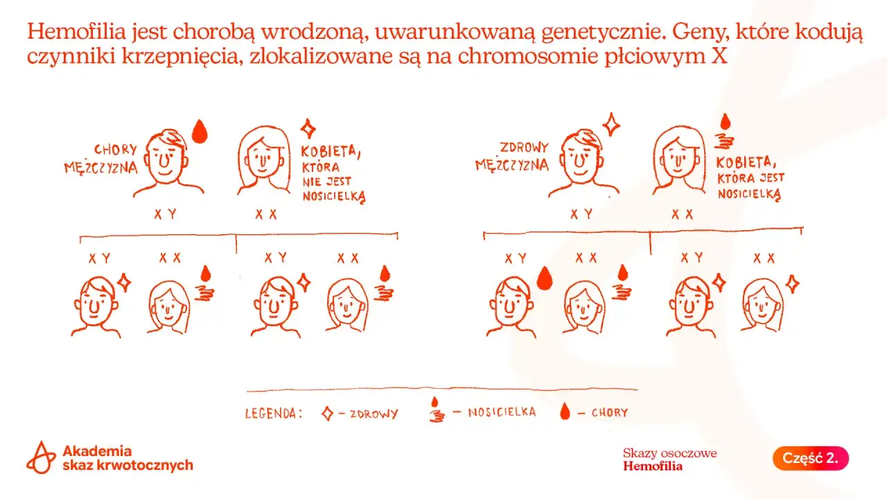 Ilustracja wyjaśnia, hemofilia co to jest: choroba genetyczna związana z chromosomem X. Pokazuje dziedziczenie u chorych i nosicielek.