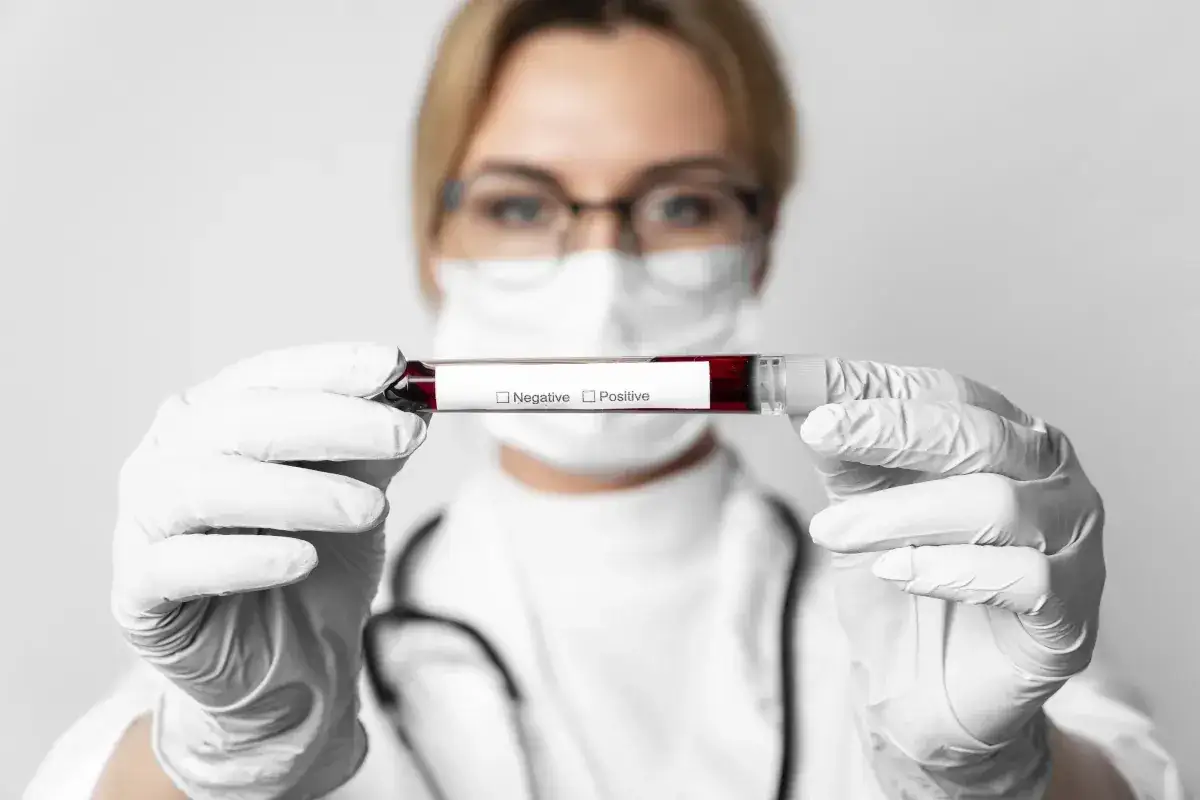 Okienko serologiczne HIV wykres