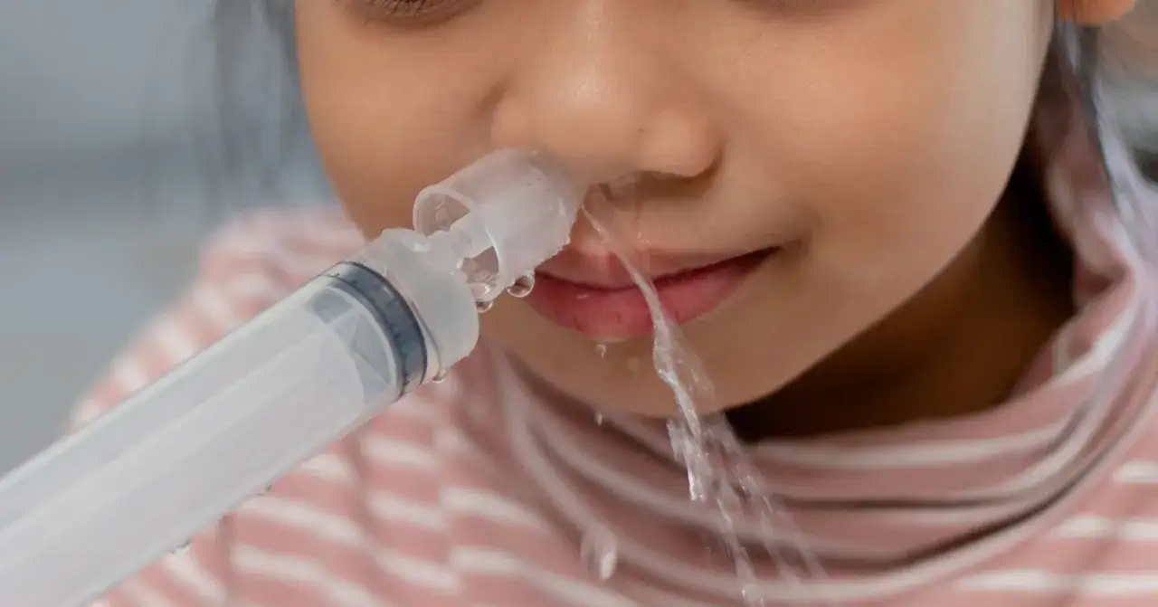 Bambina con raffreddore estivo che usa una siringa per lavaggio nasale. L'acqua fuoriesce dal naso, alleviando il fastidio.