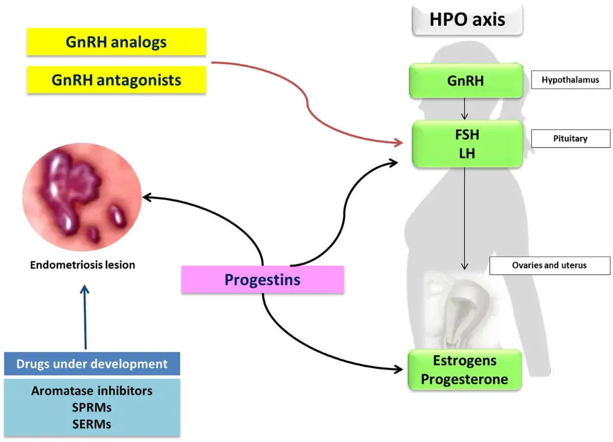 Schemat HPO osi i leczenia endometriozy. GnRH analogi i antagoniści wpływają na HPO oś, a progestyny na ogniska endometriozy.