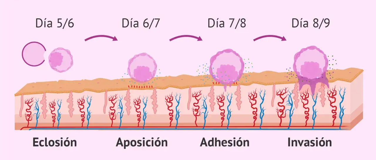 Ilustraci&oacute;n de la implantaci&oacute;n embrionaria: eclosi&oacute;n, aposici&oacute;n, adhesi&oacute;n e invasi&oacute;n del blastocisto en el endometrio.