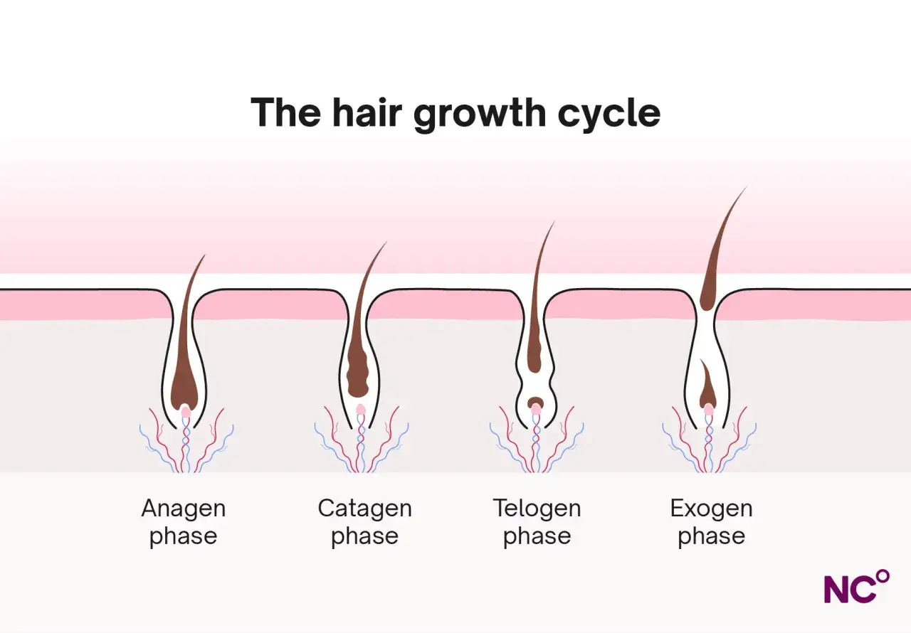 Illustration av hårtillväxtcykeln, från aktiv till vilande fas. Hormoner kan påverka detta, ibland leda till fett hår.