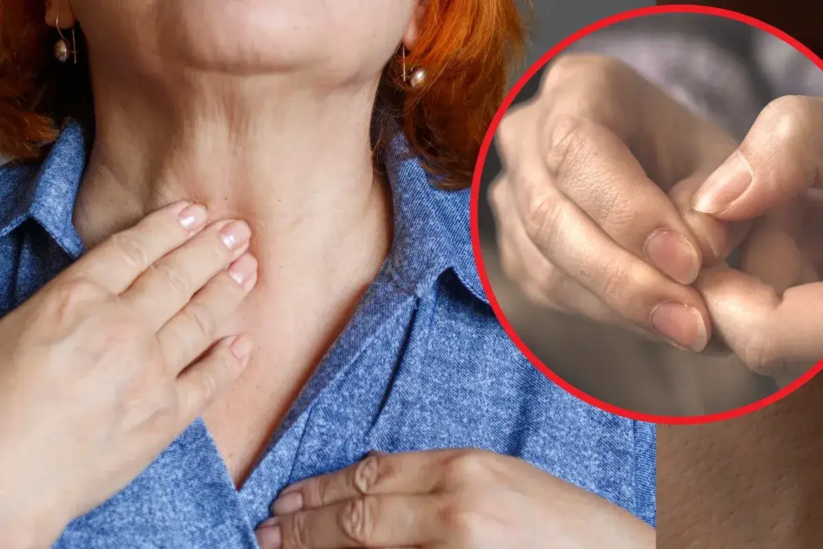 Kobieta dotyka szyi, co może sugerować problemy z tarczycą. W prawym g&oacute;rnym rogu zbliżenie na dłonie, być może nawiązujące do objaw&oacute;w sk&oacute;rnych nadczynności tarczycy.
