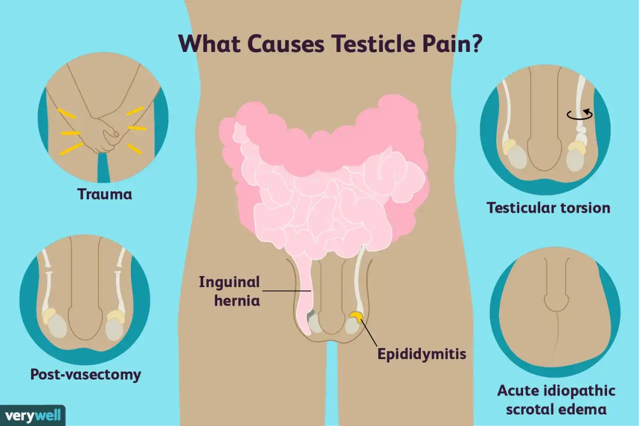 Illustration zeigt Ursachen für Hodenschmerzen: Trauma, Leistenbruch, Epididymitis, Hodenverdrehung, post-vasectomy und akutes idiopathisches Skrotalödem.