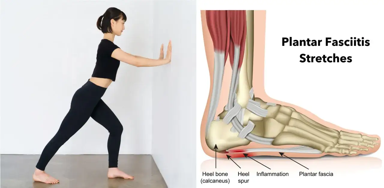 Frau dehnt die Plantarfaszie an einer Wand. Daneben eine anatomische Darstellung des Fußes mit Entzündung und Fersensporn.