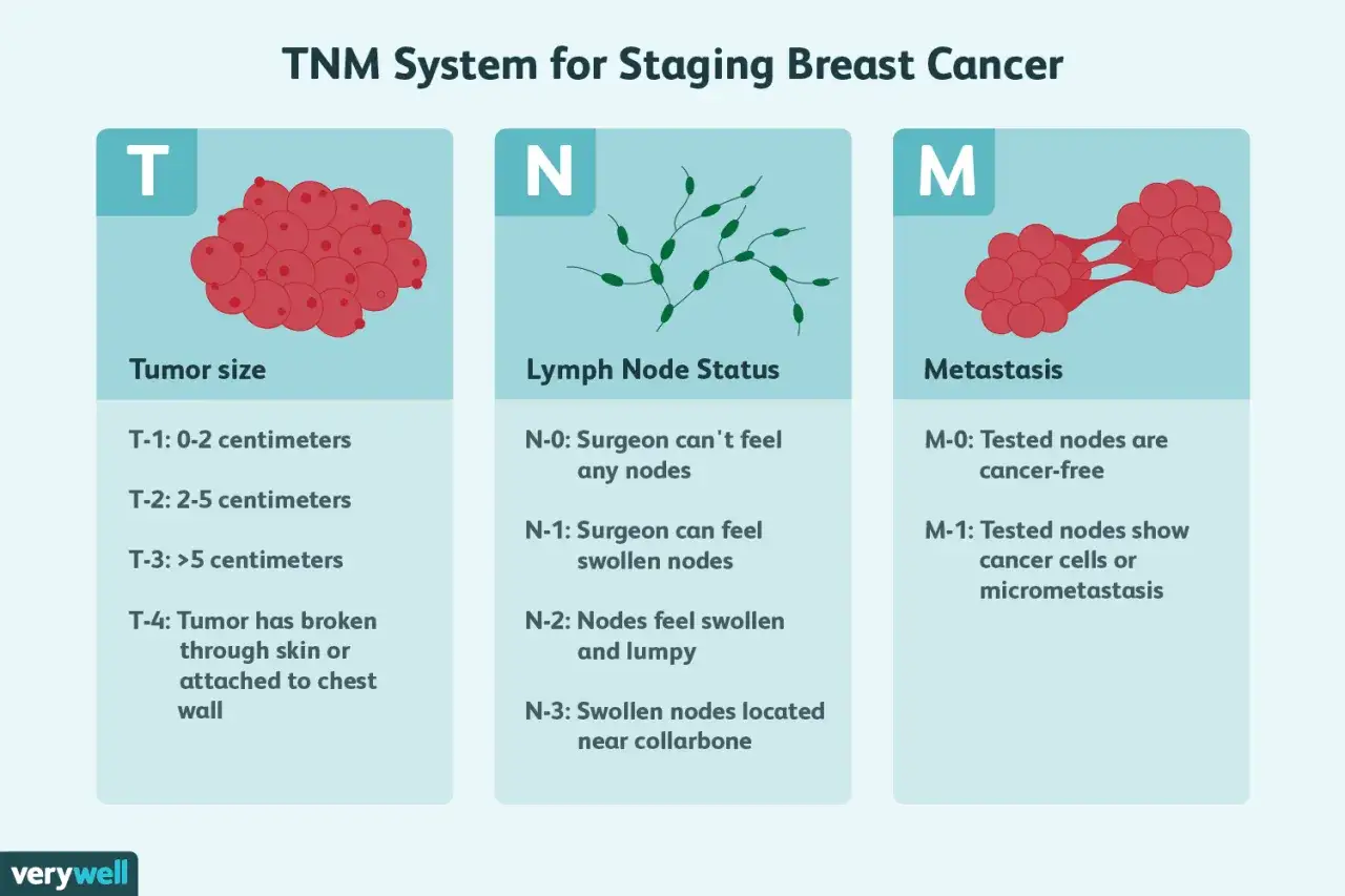 Das TNM-System zur Brustkrebs-Klassifikation erklärt Tumorgröße (T), Lymphknotenstatus (N) und Metastasierung (M).