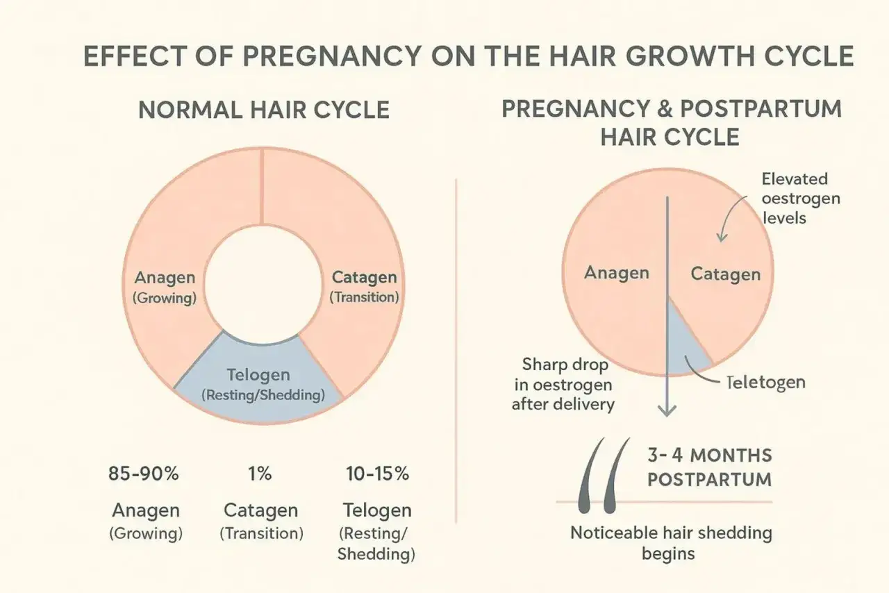 Gr&aacute;fico compara ciclos de cabello normal y postparto, explicando la ca&iacute;da de pelo postparto por ca&iacute;da de estr&oacute;genos.