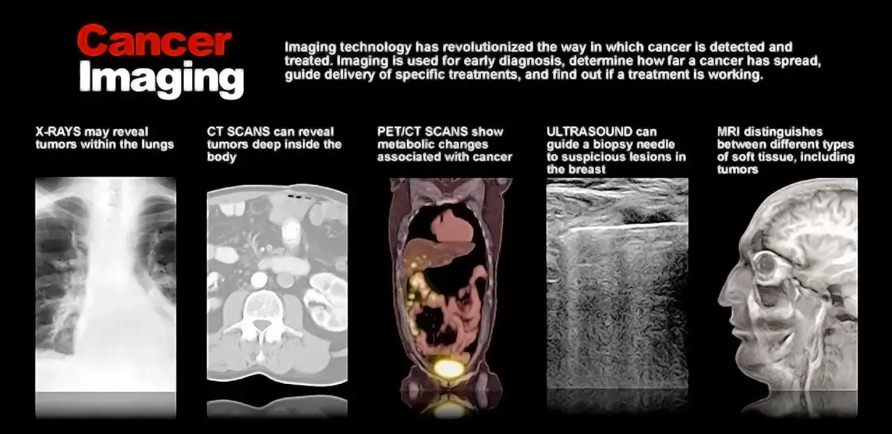 Diverse tecniche di imaging medico, come raggi X, TC, PET/TC, ecografia e RM, aiutano nel test per capire se hai un tumore, individuando e caratterizzando lesioni.