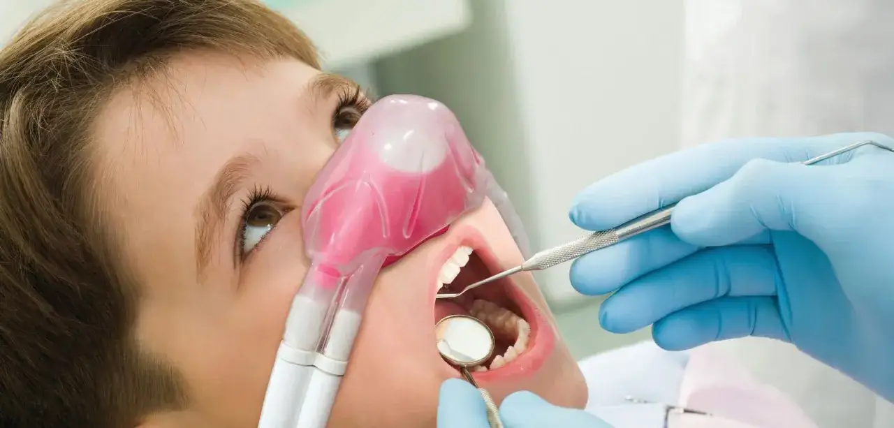 Dziecko z maską do sedacji wziewnej, przez którą podawany jest nadtlenek azotu. Dentysta bada zęby.