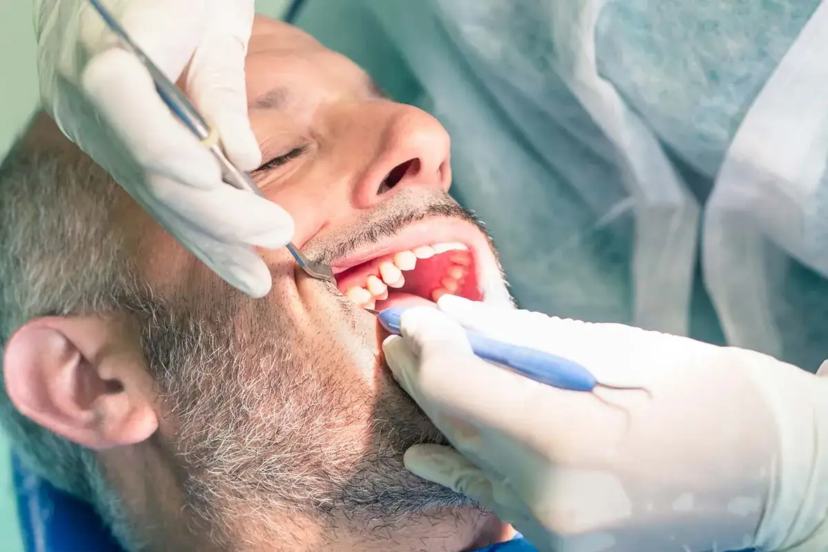 Paciente en consulta dental para elevaci&oacute;n seno maxilar. El dentista realiza procedimiento con instrumentos.