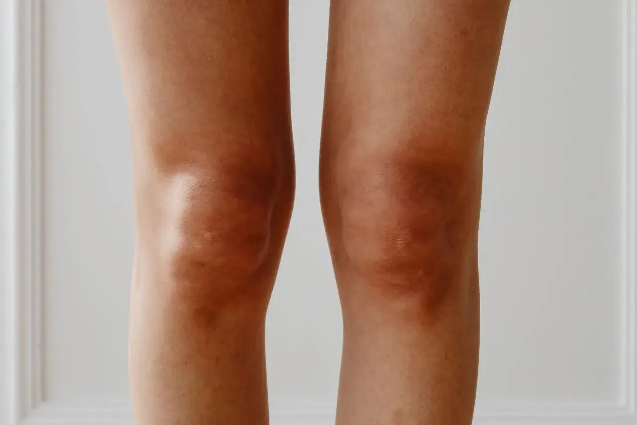 Gros plan sur les genoux d'une personne, montrant la peau bronz&eacute;e et les contours des articulations, o&ugrave; le liquide synovial assure la fluidit&eacute; des mouvements.