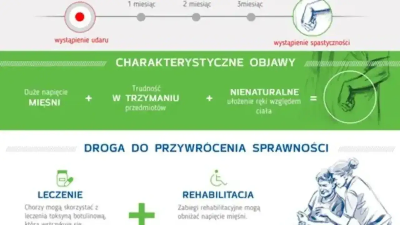 Objawy spastyczności po udarze: napięcie mięśni, trudność w trzymaniu przedmiotów, nienaturalne ułożenie ręki. Leczenie i rehabilitacja pomagają przywrócić sprawność.