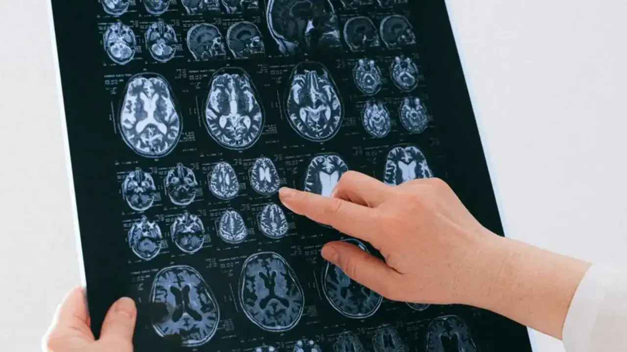 Neurologia definicja specjalizacji
