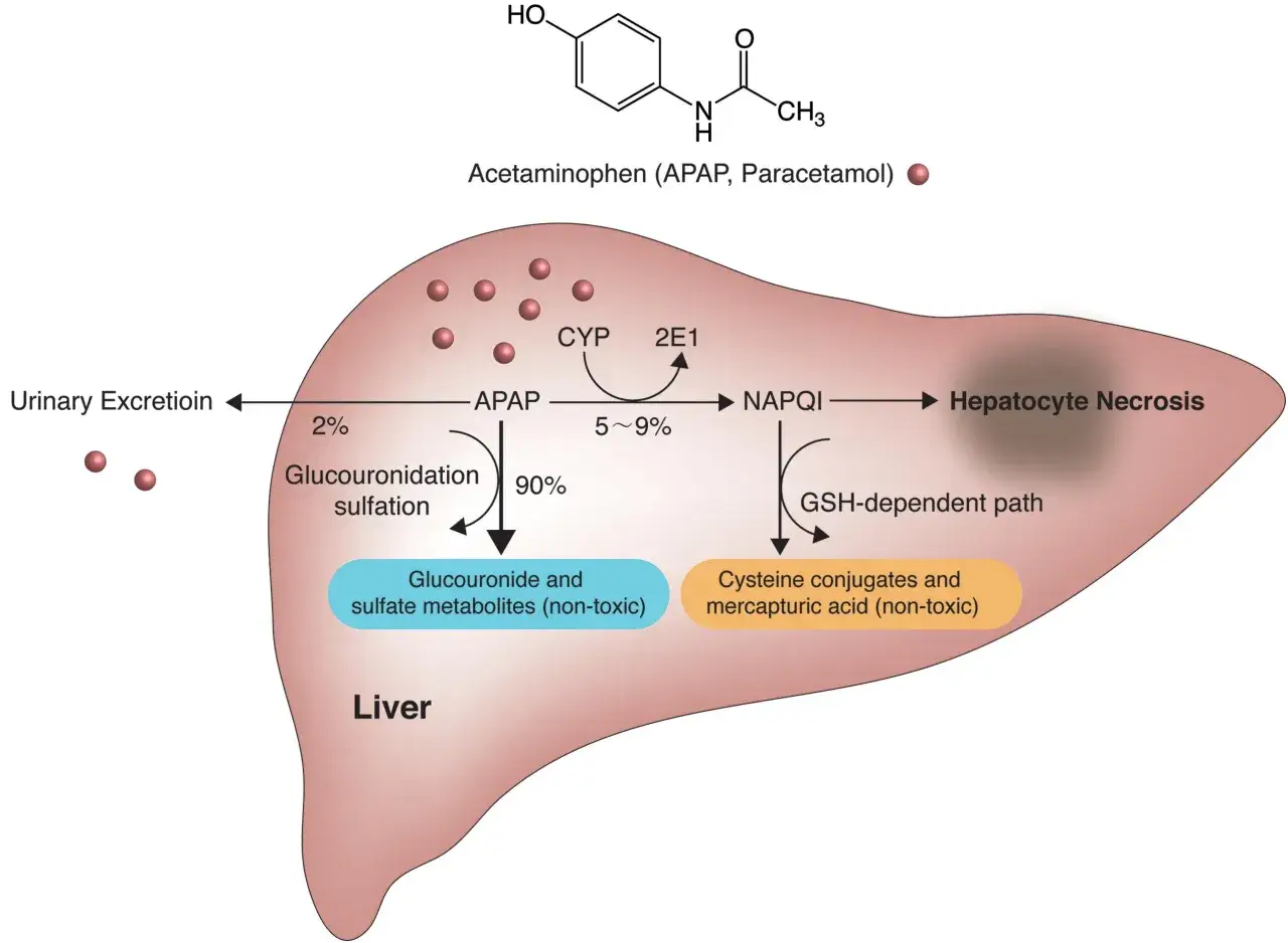 Schema del fegato che mostra il metabolismo del paracetamolo (Tachipirina). La maggior parte viene convertita in metaboliti non tossici, ma una piccola parte può causare necrosi epatica.