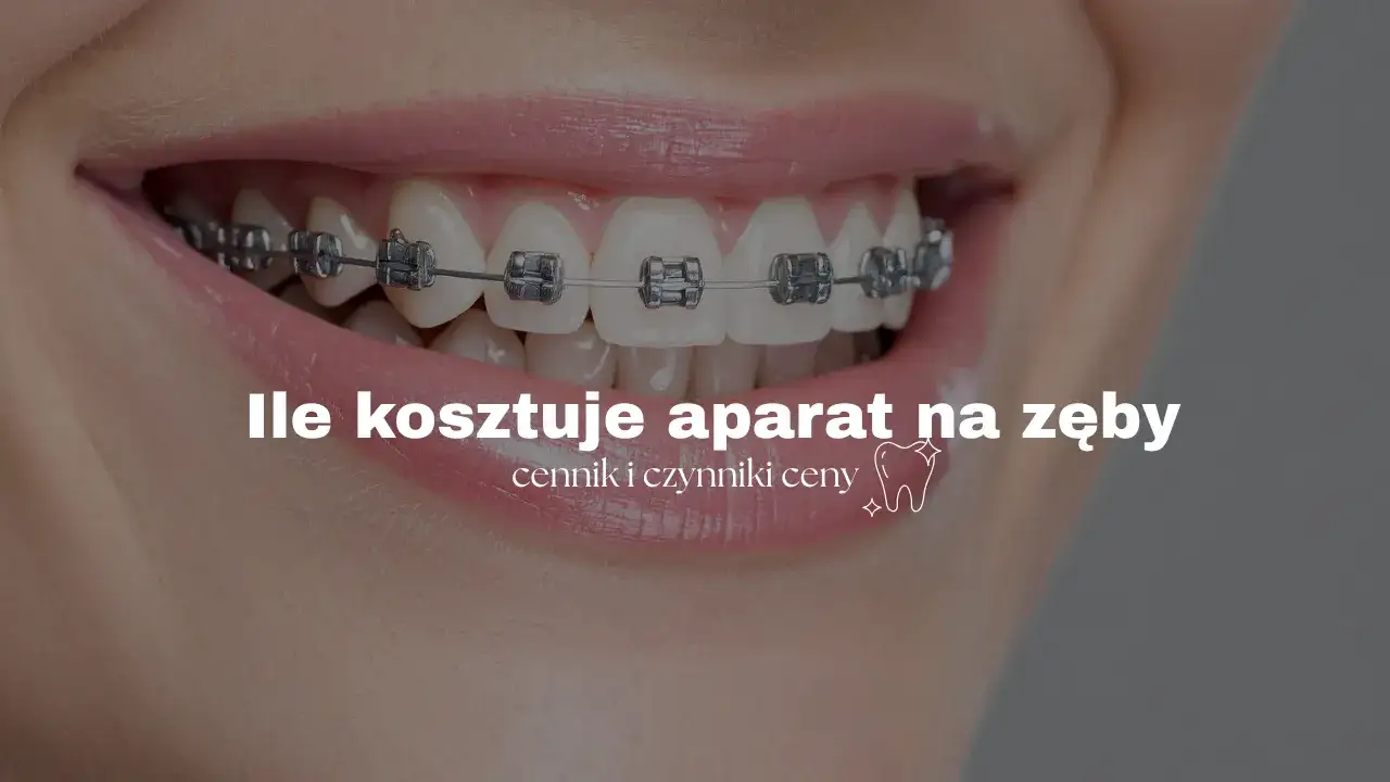 porównanie cen szyny relaksacyjnej i aparatu retencyjnego