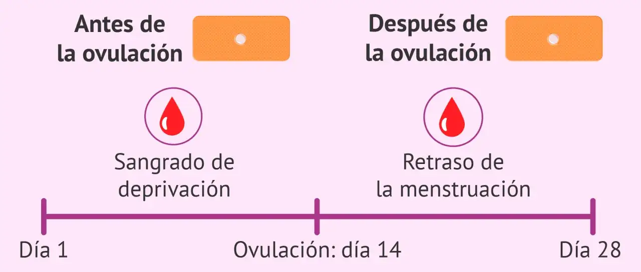 La pastilla del d&iacute;a despu&eacute;s puede causar un retraso de la menstruaci&oacute;n. El gr&aacute;fico muestra el ciclo menstrual y el sangrado de deprivaci&oacute;n.