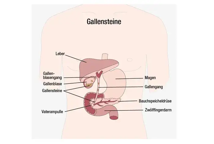 Symptome verstopfte Galleng&auml;nge &Uuml;bersicht