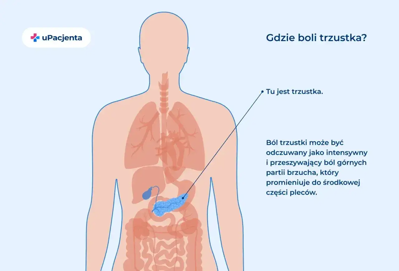 Rysunek przedstawia lokalizację trzustki w ludzkim ciele. Ból trzustki może być odczuwany w górnej części brzucha i promieniować do pleców.