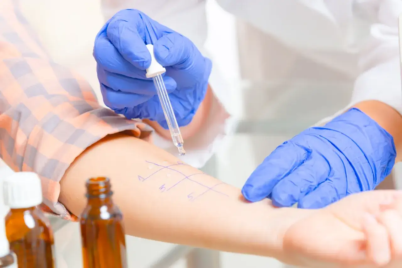 Hyposensibilisierung Behandlung Heuschnupfen