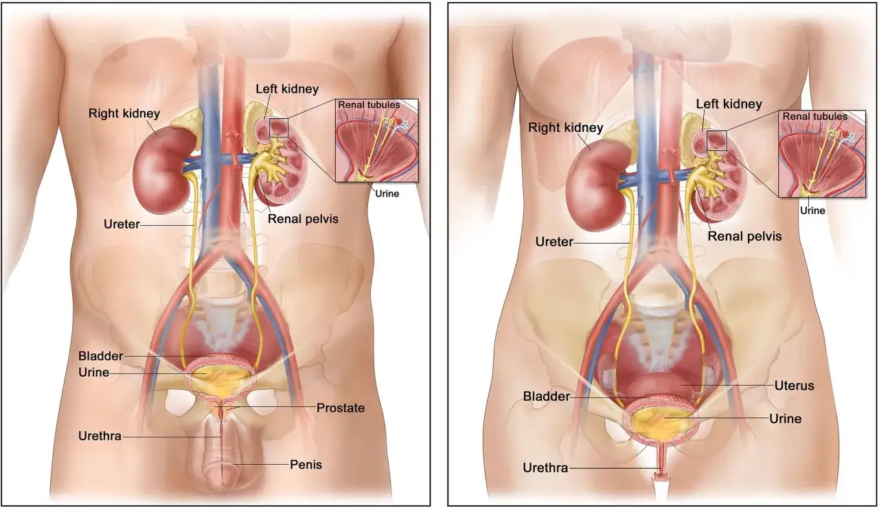 Anatomia układu moczowego, z zaznaczoną torbielą na nerce. Widoczne nerki, moczowody, pęcherz i cewka moczowa.