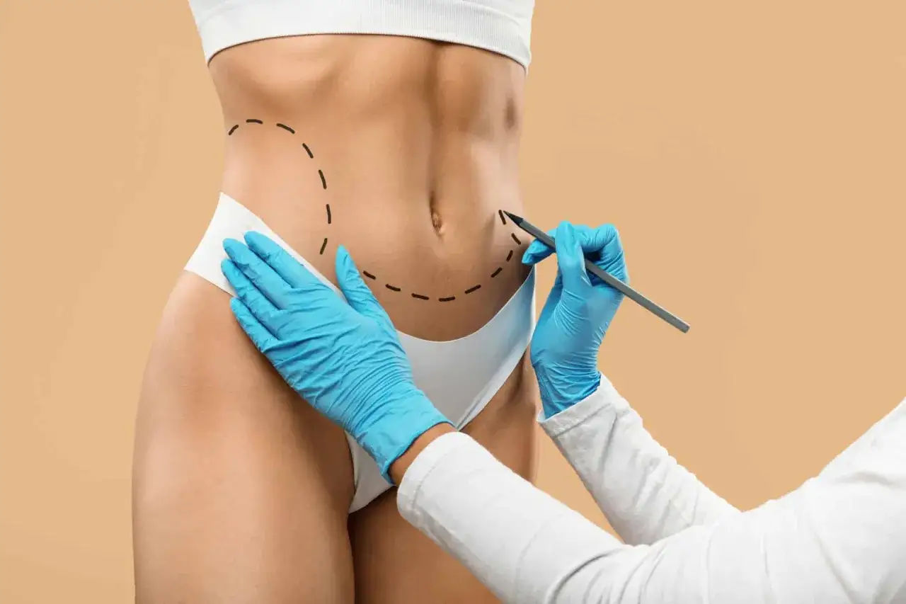 Liposukcja rekonwalescencja opuchlizna siniaki