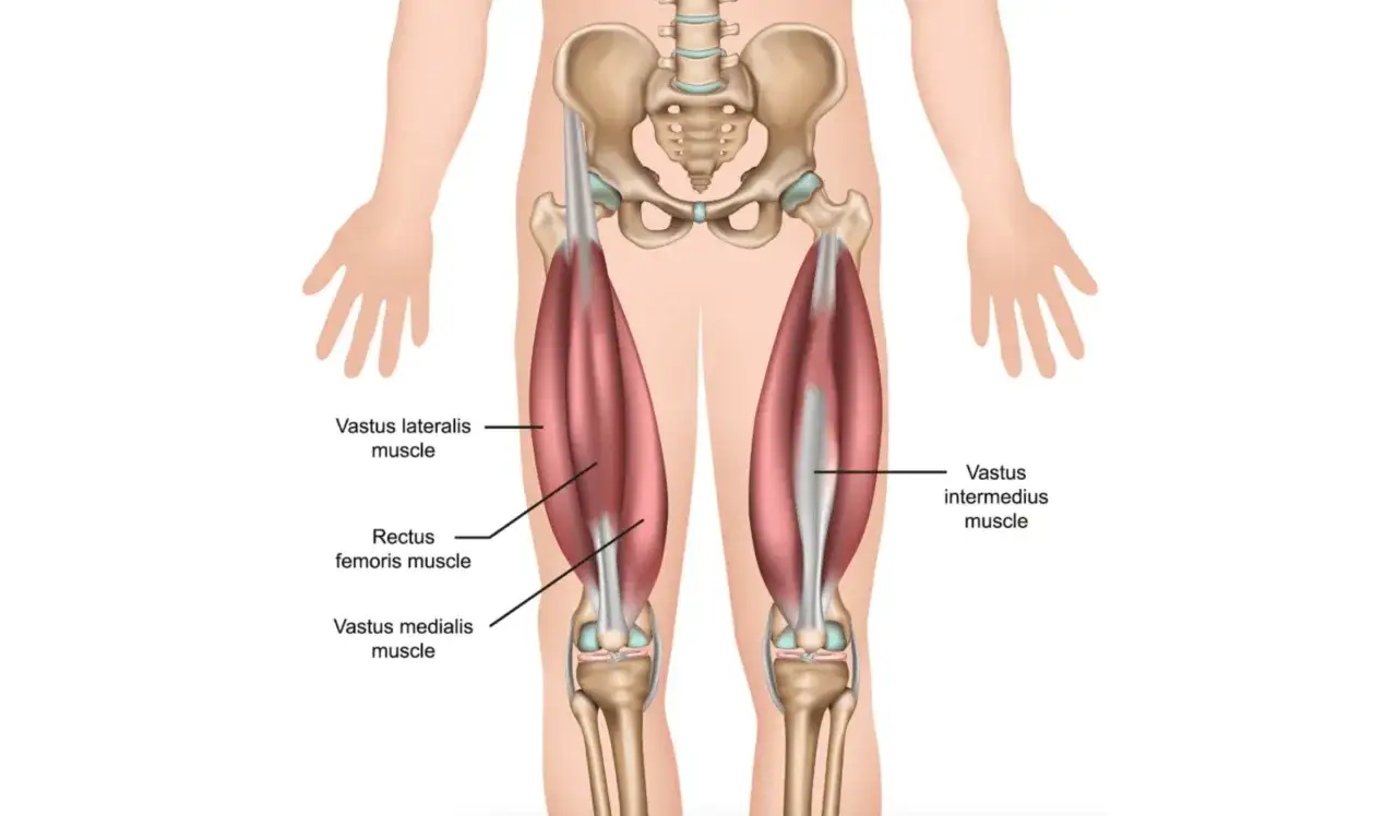 Anatomische Darstellung des menschlichen Oberschenkels mit Fokus auf den Vastus lateralis Muskel, der Teil des Quadrizeps ist.