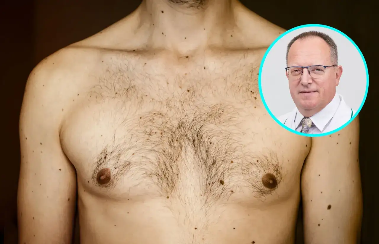 Jak wykonać samobadanie piersi mężczyzny