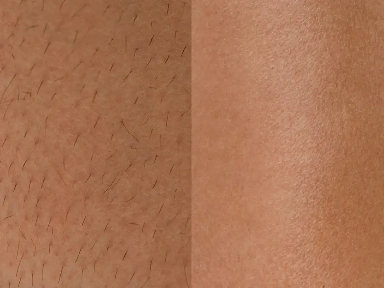 Före och efter vaxa benen. Till vänster syns hårstrån, till höger slät hud.