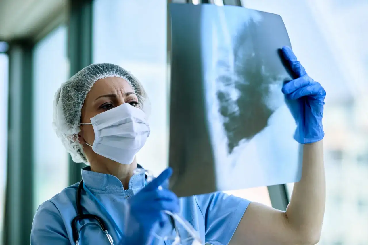 Medico esamina radiografia polmonare, valutando un caso di polmonite nosocomiale e le possibili implicazioni per un risarcimento.