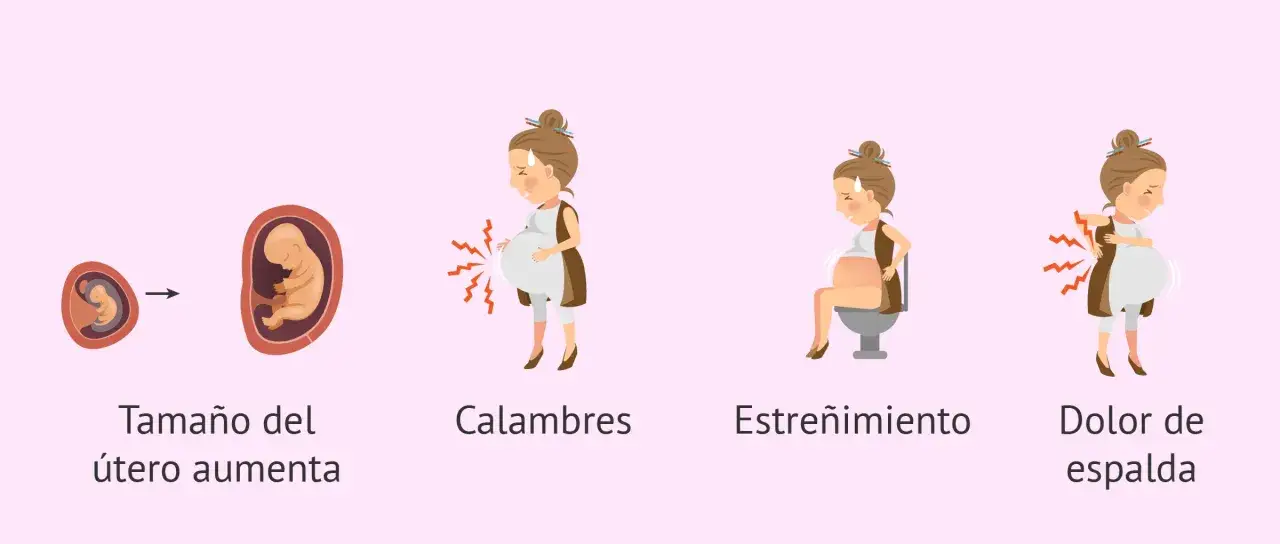 Ilustraci&oacute;n muestra el crecimiento del &uacute;tero y beb&eacute;, calambres, estre&ntilde;imiento y dolor de espalda, s&iacute;ntomas comunes de 16 semanas de embarazo.