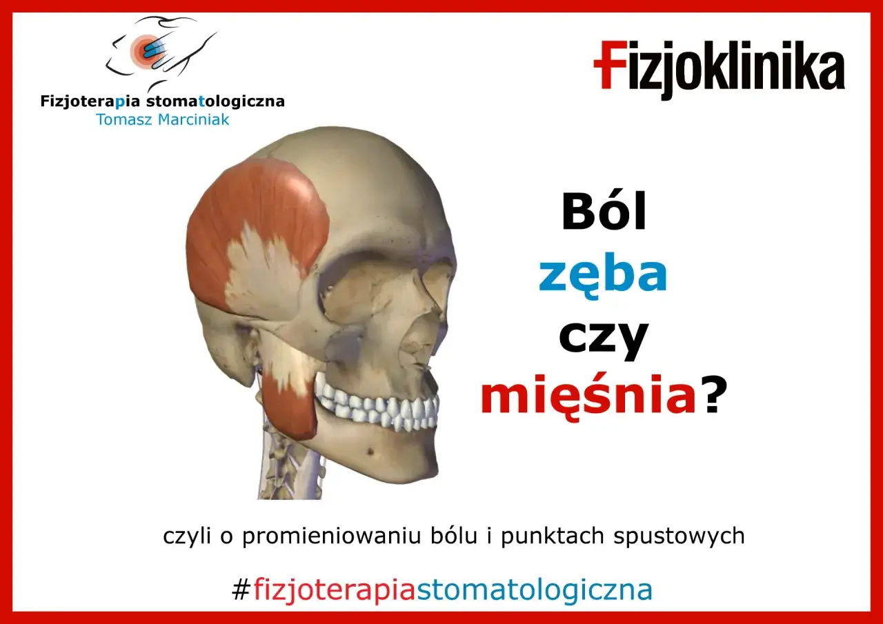 Model czaszki z zaznaczonym mięśniem żwaczem. Pytanie: Ból zęba czy mięśnia? Wskazuje na bóle szczęki.