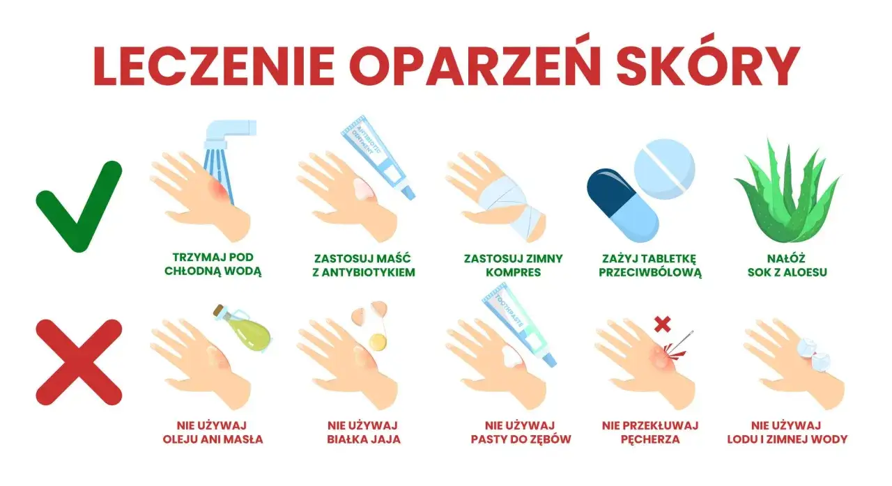 Porady dotyczące leczenia oparzeń: chłodna woda, maść z antybiotykiem, zimny kompres, leki przeciwbólowe, aloes. Unikaj masła, jajek, pasty do zębów, przekłuwania pęcherzy i lodu.