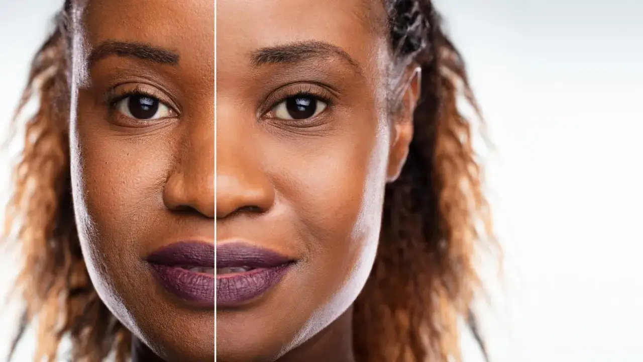 Split image shows a woman's face before and after microdermabrasion. The right side, after treatment, reveals smoother, clearer skin. This treatment can be done every 2-4 weeks.