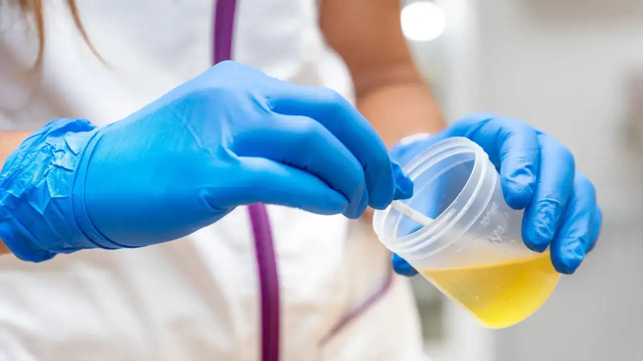 Person in blauen Handschuhen entnimmt Probe aus Becher. Dies k&ouml;nnte relevant sein, wenn man wissen m&ouml;chte, wie lange CBD im K&ouml;rper bleibt.