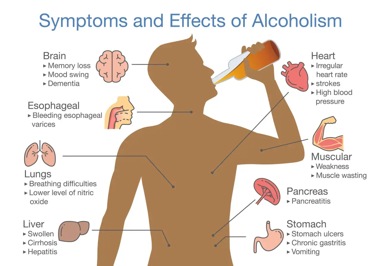 Ilustracja pokazuje alkoholizm objawy: problemy z mózgiem, sercem, płucami, wątrobą, żołądkiem i mięśniami.