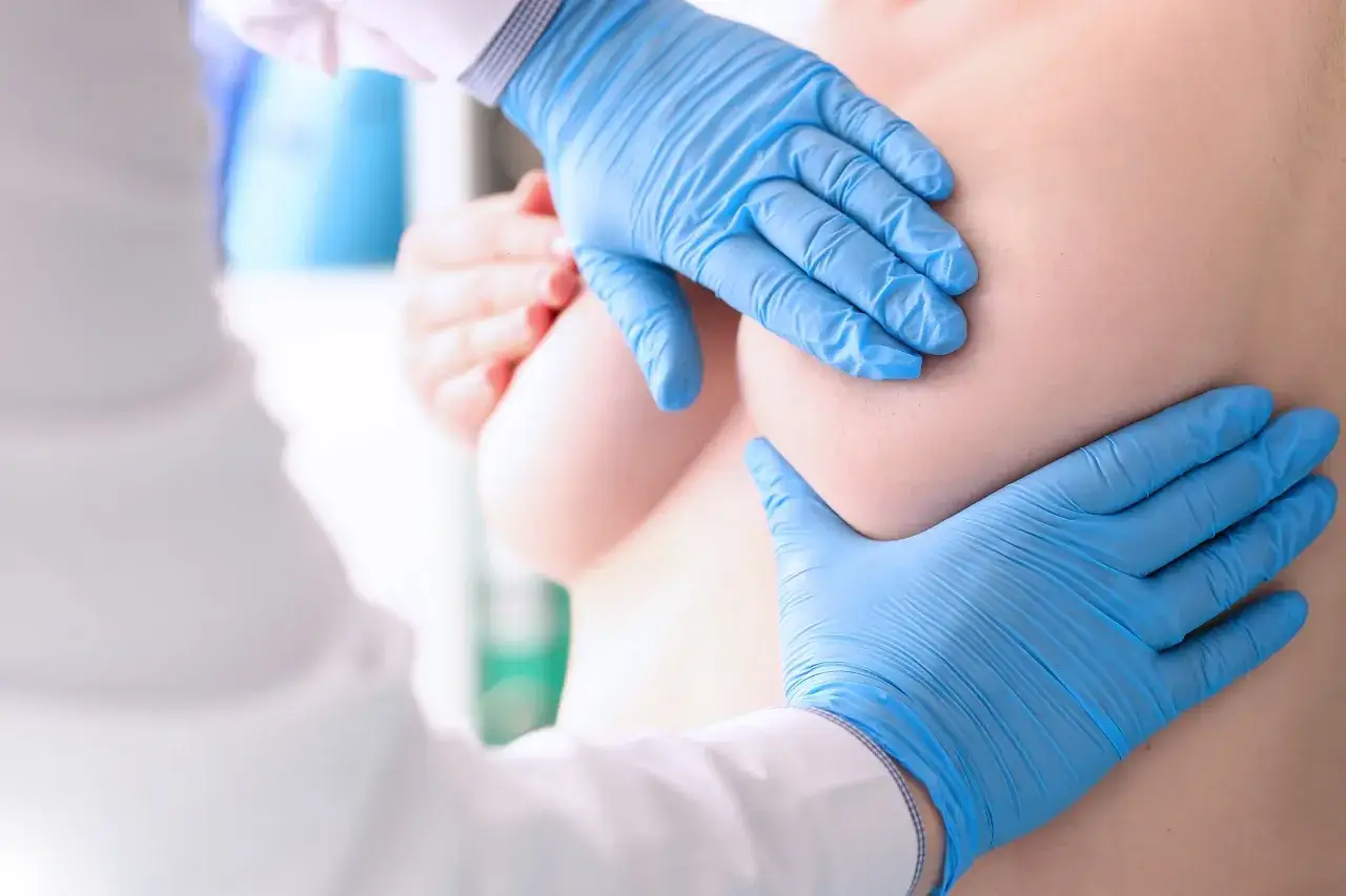 Lekarz w niebieskich rękawiczkach bada pierś pacjentki. To ważny etap diagnostyki, który może poprzedzać decyzję o mastektomii.