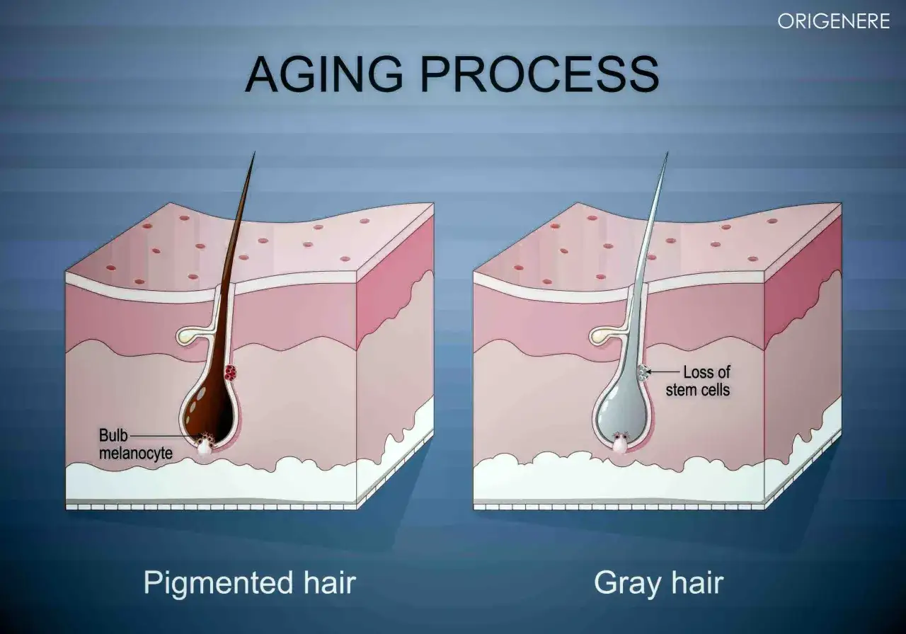 El pelo pigmentado tiene melanocitos en el bulbo, mientras que el pelo gris muestra p&eacute;rdida de c&eacute;lulas madre.
